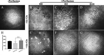 Protective Effects Oncorneal Endothelium During Intracameral Irrigation Using N-(2)-l-alanyl-l-Glutamine